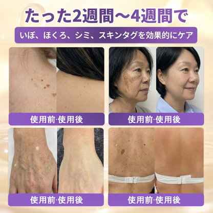 日本製・国内発送✨ 𝐆𝐎𝐋𝐃𝐊𝐈𝐒𝐒® 𝐆𝐇𝐊-𝐂𝐮 & 𝐁𝐈𝐎𝐓𝐈𝐍 𝟏𝟎-𝐈𝐍-𝟏「ゴールドキッス ® GHK-Cu ＆ ビオチン 10-in-1」スキンリストアクリーム⚡贅沢な美容成分が 1 つに凝縮！！