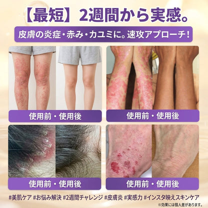 日本製・国内発送✨ 𝐆𝐎𝐋𝐃𝐊𝐈𝐒𝐒® 𝐆𝐇𝐊-𝐂𝐮 & 𝐁𝐈𝐎𝐓𝐈𝐍 𝟏𝟎-𝐈𝐍-𝟏「ゴールドキッス ® GHK-Cu ＆ ビオチン 10-in-1」スキンリストアクリーム⚡贅沢な美容成分が 1 つに凝縮！！
