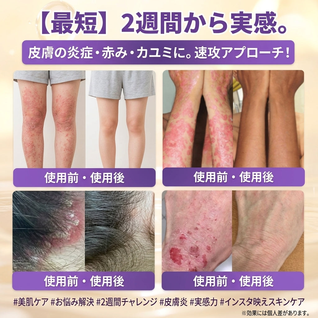 日本製・国内発送✨ 𝐆𝐎𝐋𝐃𝐊𝐈𝐒𝐒® 𝐆𝐇𝐊-𝐂𝐮 & 𝐁𝐈𝐎𝐓𝐈𝐍 𝟏𝟎-𝐈𝐍-𝟏⭐「ゴールドキッス ® GHK-Cu ＆ ビオチン 10-in-1」スキンリストアクリーム⚡贅沢な美容成分が 1 つに凝縮！
