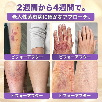 日本製・国内発送✨ 𝐆𝐎𝐋𝐃𝐊𝐈𝐒𝐒® 𝐆𝐇𝐊-𝐂𝐮 & 𝐁𝐈𝐎𝐓𝐈𝐍 𝟏𝟎-𝐈𝐍-𝟏⭐「ゴールドキッス ® GHK-Cu ＆ ビオチン 10-in-1」スキンリストアクリーム⚡贅沢な美容成分が 1 つに凝縮！