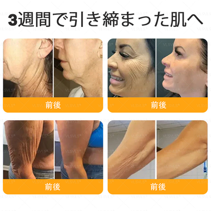 🇯🇵 日本製・日本から直送 🥇🥇  𝑽𝑳𝑺𝑽𝑳𝑺® ビーベノム コンプリヘンシブ クリーム  本日最終日｜80％OFF（肌のたるみ、乾燥による小ジワ、ハリ不足、バストラインやヒップラインの印象など、年齢とともに気になるボディスキンをトータルケア。うるおいとハリを与え、なめらかで引き締まった印象の肌へ導きます）