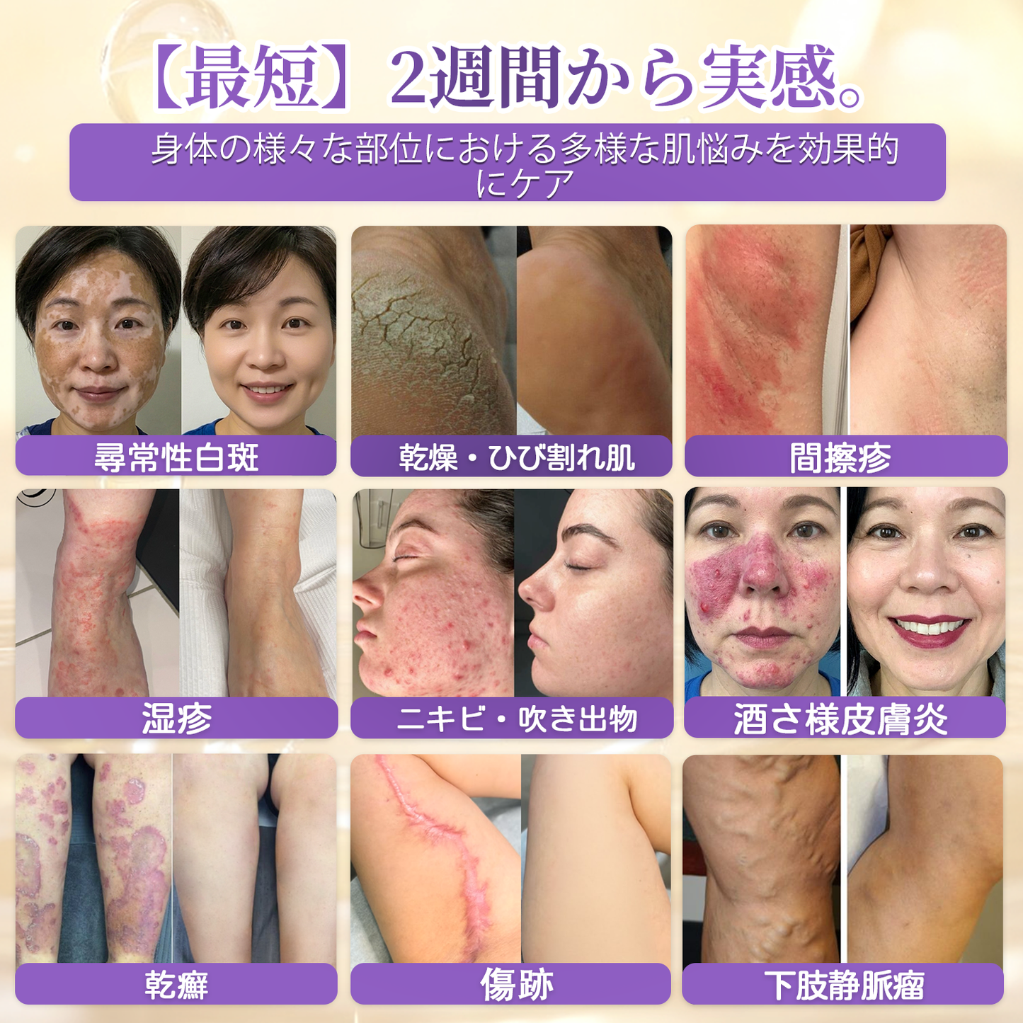 日本製・国内発送✨ 𝐆𝐎𝐋𝐃𝐊𝐈𝐒𝐒® 𝐆𝐇𝐊-𝐂𝐮 & 𝐁𝐈𝐎𝐓𝐈𝐍 𝟏𝟎-𝐈𝐍-𝟏「ゴールドキッス ® GHK-Cu ＆ ビオチン 10-in-1」スキンリストアクリーム⚡贅沢な美容成分が 1 つに凝縮！！