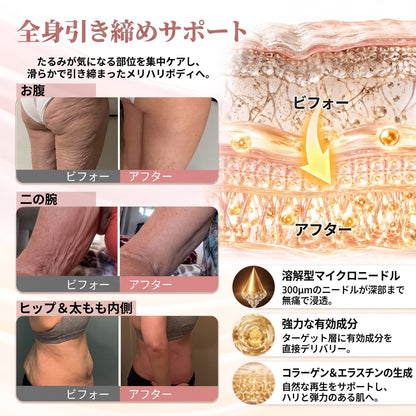 HISKIN® バストアップ・リフトアップ＆ハリ・弾力ケア マイクロニードルパッチ