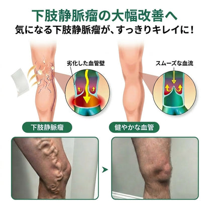 👨‍⚕️✅✅𝐂𝐨𝐚𝐮𝐨𝐨® 静脈ターゲット「コアウォー ® ヴェインターゲット」・マイクロニードルパッチ⚡即効ケア＆長期サポート ビッグセール