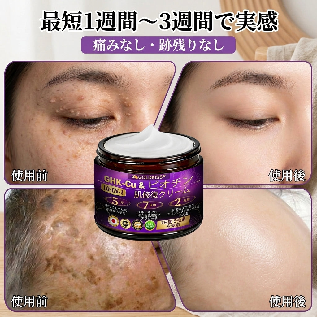 日本製・国内発送✨ 𝐆𝐎𝐋𝐃𝐊𝐈𝐒𝐒® 𝐆𝐇𝐊-𝐂𝐮 & 𝐁𝐈𝐎𝐓𝐈𝐍 𝟏𝟎-𝐈𝐍-𝟏⭐「ゴールドキッス ® GHK-Cu ＆ ビオチン 10-in-1」スキンリストアクリーム⚡贅沢な美容成分が 1 つに凝縮！