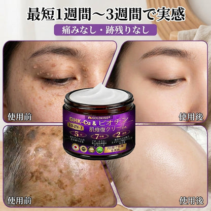 日本製・国内発送✨ 𝐆𝐎𝐋𝐃𝐊𝐈𝐒𝐒® 𝐆𝐇𝐊-𝐂𝐮 & 𝐁𝐈𝐎𝐓𝐈𝐍 𝟏𝟎-𝐈𝐍-𝟏⭐「ゴールドキッス ® GHK-Cu ＆ ビオチン 10-in-1」スキンリストアクリーム⚡贅沢な美容成分が 1 つに凝縮！