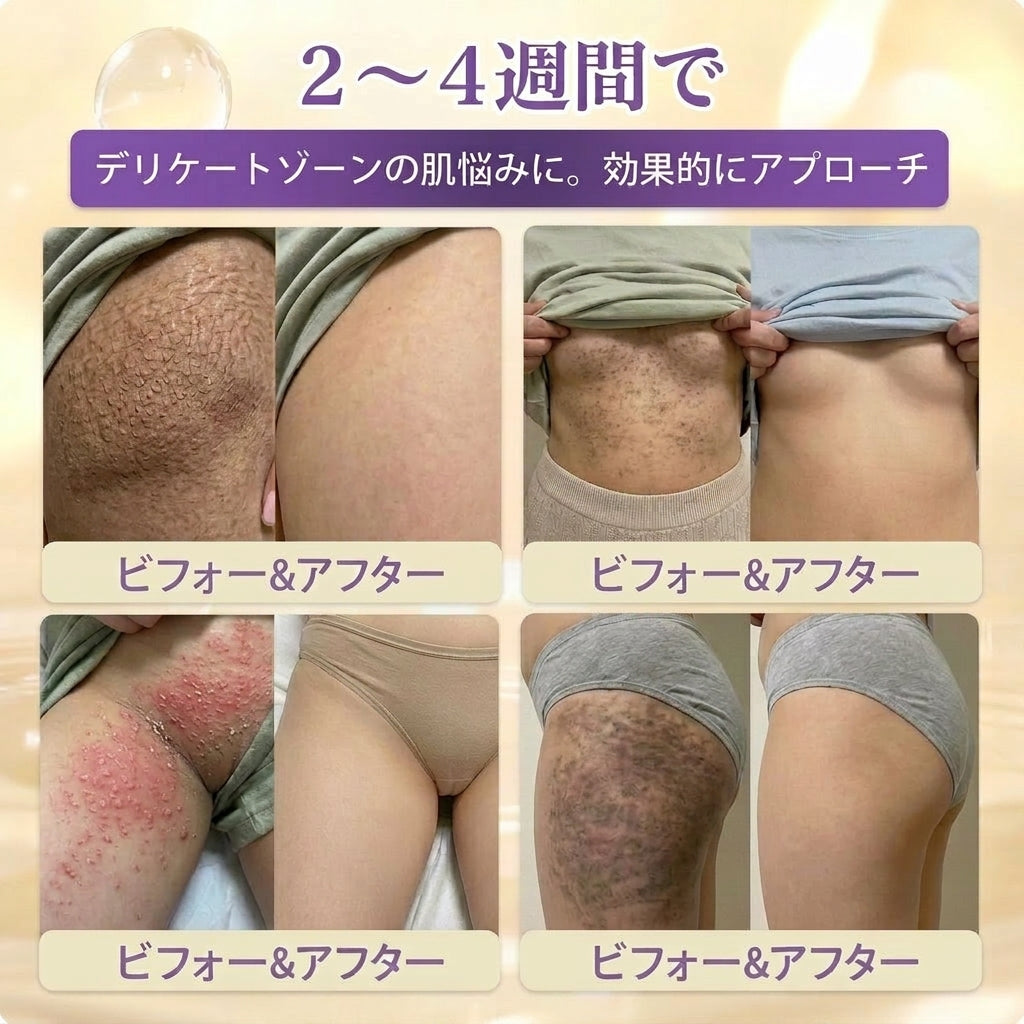 日本製・国内発送✨ 𝐆𝐎𝐋𝐃𝐊𝐈𝐒𝐒® 𝐆𝐇𝐊-𝐂𝐮 & 𝐁𝐈𝐎𝐓𝐈𝐍 𝟏𝟎-𝐈𝐍-𝟏「ゴールドキッス ® GHK-Cu ＆ ビオチン 10-in-1」スキンリストアクリーム⚡贅沢な美容成分が 1 つに凝縮！！