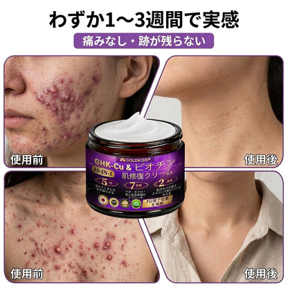 日本製・国内発送✨ 𝐆𝐎𝐋𝐃𝐊𝐈𝐒𝐒® 𝐆𝐇𝐊-𝐂𝐮 & 𝐁𝐈𝐎𝐓𝐈𝐍 𝟏𝟎-𝐈𝐍-𝟏「ゴールドキッス ® GHK-Cu ＆ ビオチン 10-in-1」スキンリストアクリーム⚡贅沢な美容成分が 1 つに凝縮！！