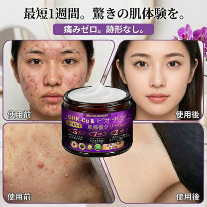 日本製・国内発送✨ 𝐆𝐎𝐋𝐃𝐊𝐈𝐒𝐒® 𝐆𝐇𝐊-𝐂𝐮 & 𝐁𝐈𝐎𝐓𝐈𝐍 𝟏𝟎-𝐈𝐍-𝟏「ゴールドキッス ® GHK-Cu ＆ ビオチン 10-in-1」スキンリストアクリーム⚡贅沢な美容成分が 1 つに凝縮！！
